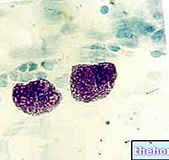 Mastociti - alergije