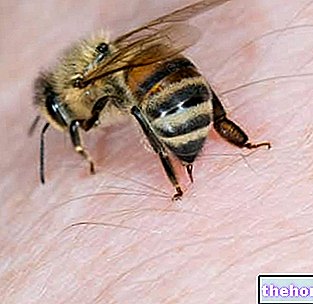 Piqûre d'abeille : que faire ? - allergies