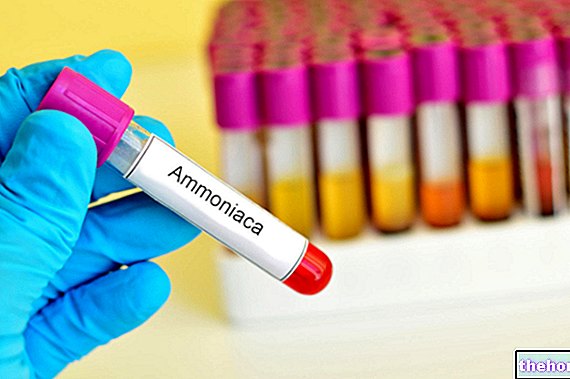 Ammonémie, Ammoniac dans le sang - analyse de sang
