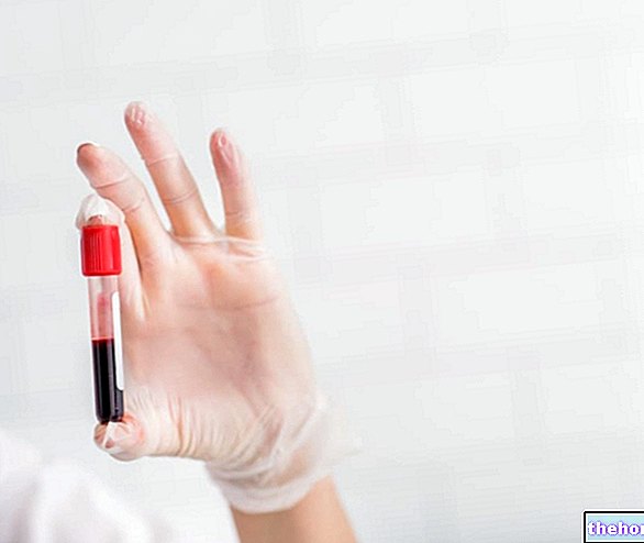 Δοκιμές αίματος - εξετάσεις αίματος - ανάλυση αίματος