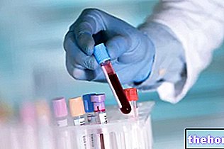 Beljakovine S - analiza krvi