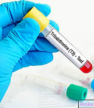 Trijodotironin u krvi - ukupni T3, slobodni T3
