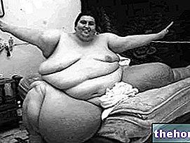 Lelaki paling gemuk di dunia - antropometri