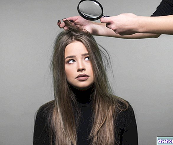 hår - Oljig mjäll: orsaker och behandling