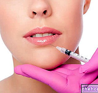 Fillers - Cosmetic Surgery