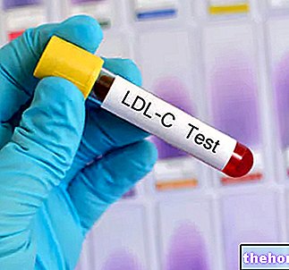 Calcul des valeurs idéales de cholestérol LDL - cholestérol