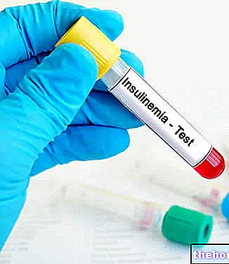 Insulinemija - Kraujo analizė - - diabetas