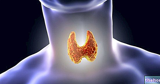 Thyroiditis - diagnosis-diseases