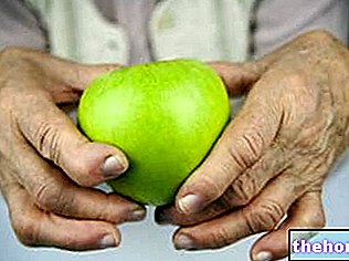 Reumatoidni artritis: dijeta, suplementi, alternativne terapije - dijeta i zdravlje