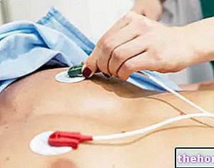 Elektrokardiogram - peperiksaan