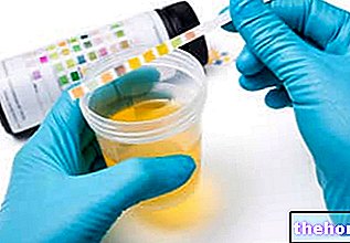 Uriini uurimine - uriini analüüs - eksamid
