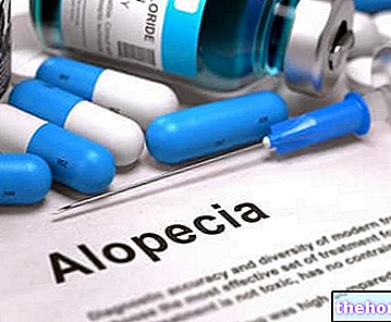 Obat untuk Mengobati Alopecia Areata