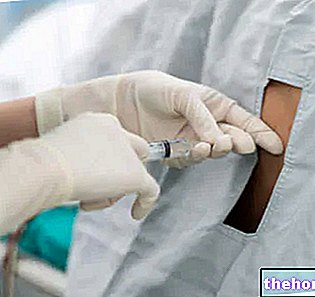 Epidural - Epidural anestesi - kirurgiska ingrepp