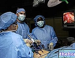 Laparoskopia - kirurgiset toimenpiteet