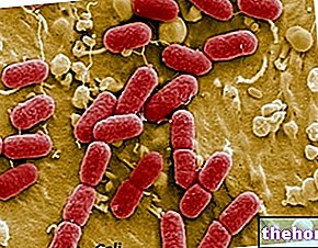 Escherichia coli ja ruoka -taudit - ruokaan liittyvät sairaudet