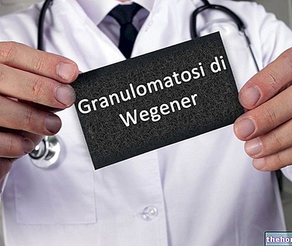 Wegenerova granulomatóza - granulomatóza s polyangiitídou - autoimunitné choroby