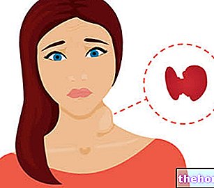 Autoimuni tiroiditis - autoimune bolesti