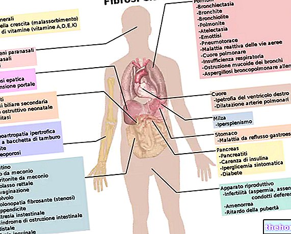 सिस्टिक फाइब्रोसिस - निदान और चिकित्सा - आनुवंशिक रोग