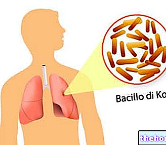 nakkushaigused - Kochi bacillus