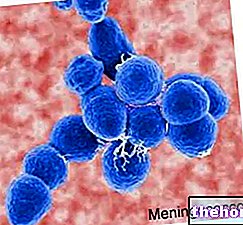 Meningococcus - fertőző betegségek
