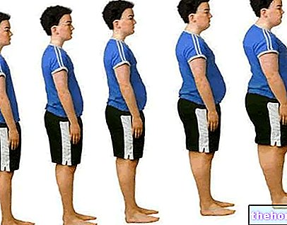 Obezita a osobní trenér - obezita