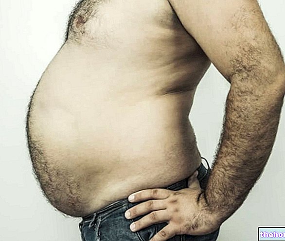 Druhy břicha - obezita