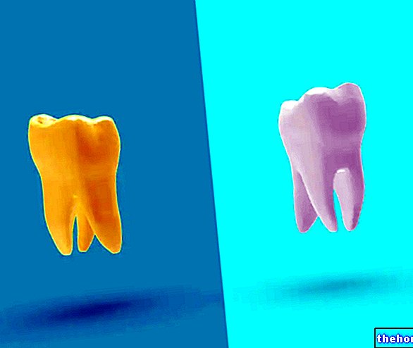 Kollased hambad - hambad-tervis