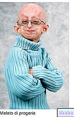 Progerija - zdravje otroka