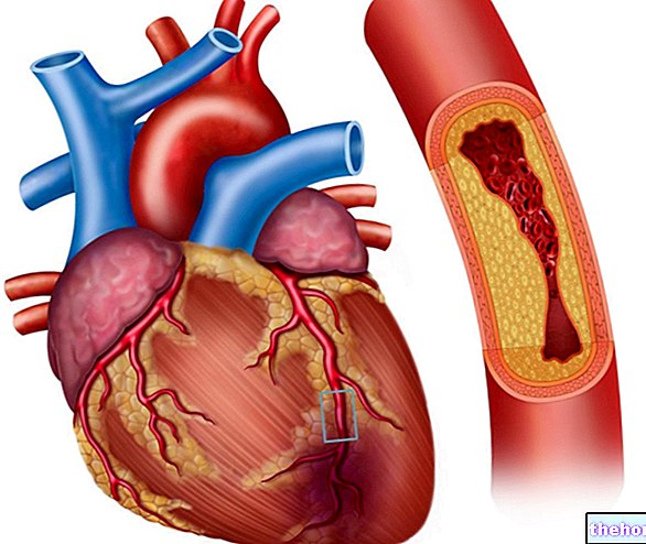 Koronari - kesihatan jantung