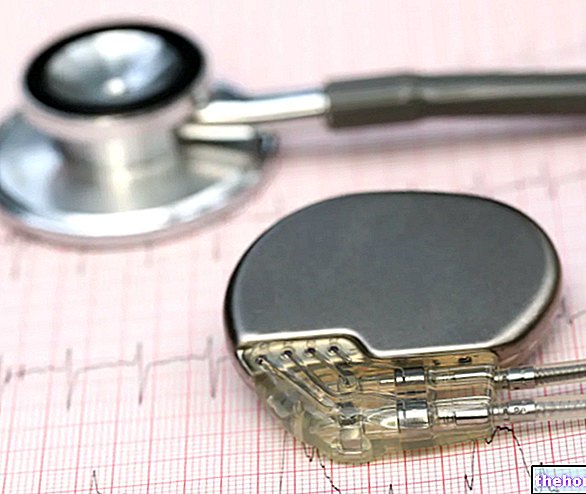 Stimulateur cardiaque : qu'est-ce que c'est ? A quoi ça sert et Intervention - coeur-santé
