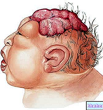 Anencefalia - sikiön terveydelle