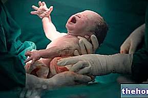 Kusepõie eksstrofia - beebi tervis