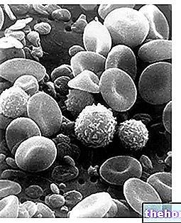 Anemia Aplastik - kesihatan darah