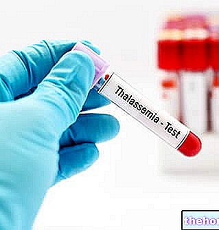 Anemia Mediterranean - kesihatan darah