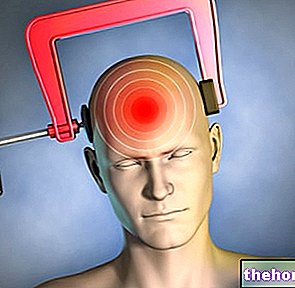 Sakit kepala yang sengit - kesihatan sistem saraf