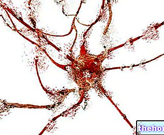 Maladies neurodégénératives - santé-du-système-nerveux