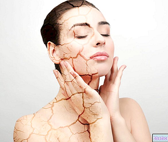 Prostředky na suchou kůži - zdraví kůže