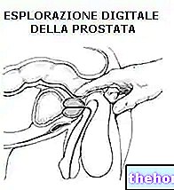 Exploration rectale numérique de la prostate - prostate-santé