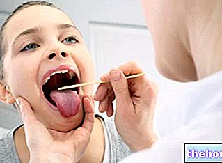 Hypertrofiske tonsiller - Hypertrofi af tonsillerne - åndedræts-sundhed
