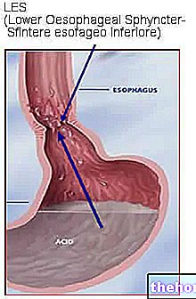 Reflux gastro-œsophagien - RGO : définition, causes, symptômes - santé de l'œsophage