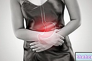 Gastritis akut - kesihatan perut
