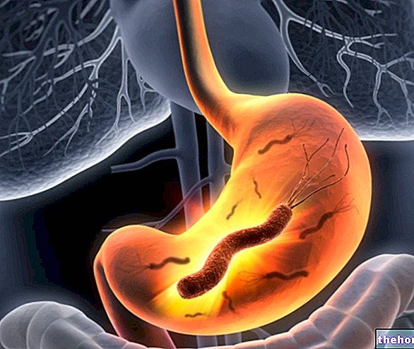 Helicobacter pylori: Contagion and Symptoms - stomach-health