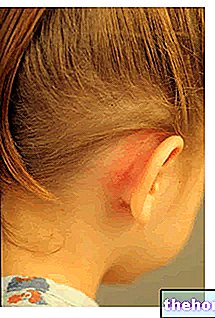 Мастоидит - здраве на ушите