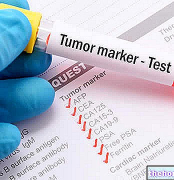 Marqueurs tumoraux - tumeurs